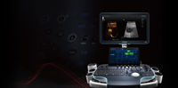 High end color Doppler ultrasound system Resona R9